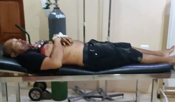 Asesinan a hombre de cinco balazos en Laguna de Perlas, Caribe Sur de Nicaragua