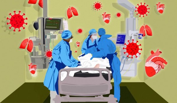 Coronavirus | De enfermedad respiratoria a multisistémica: cómo en pocas semanas cambió radicalmente lo que sabemos sobre la covid-19