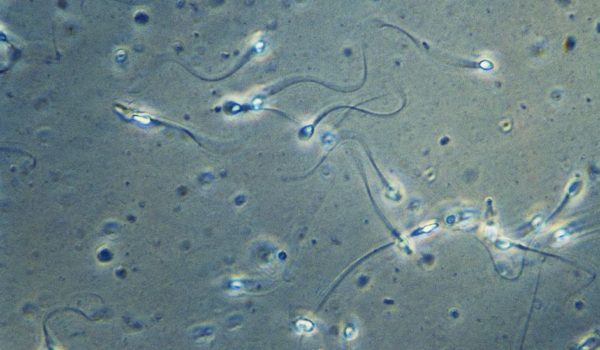 La sorprendente forma en que realmente nadan los espermatozoides