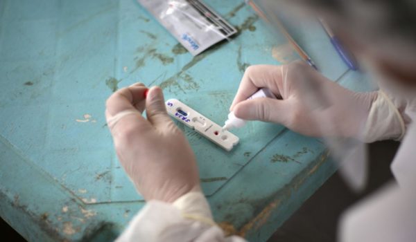 Coronavirus: qué se sabe sobre la nueva variante encontrada en Brasil (y que llegó a Japón)