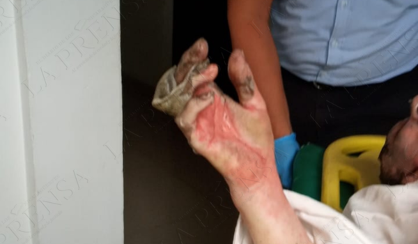 Fallece anciana que resultó con quemaduras de primer y segundo grado en incendio en León