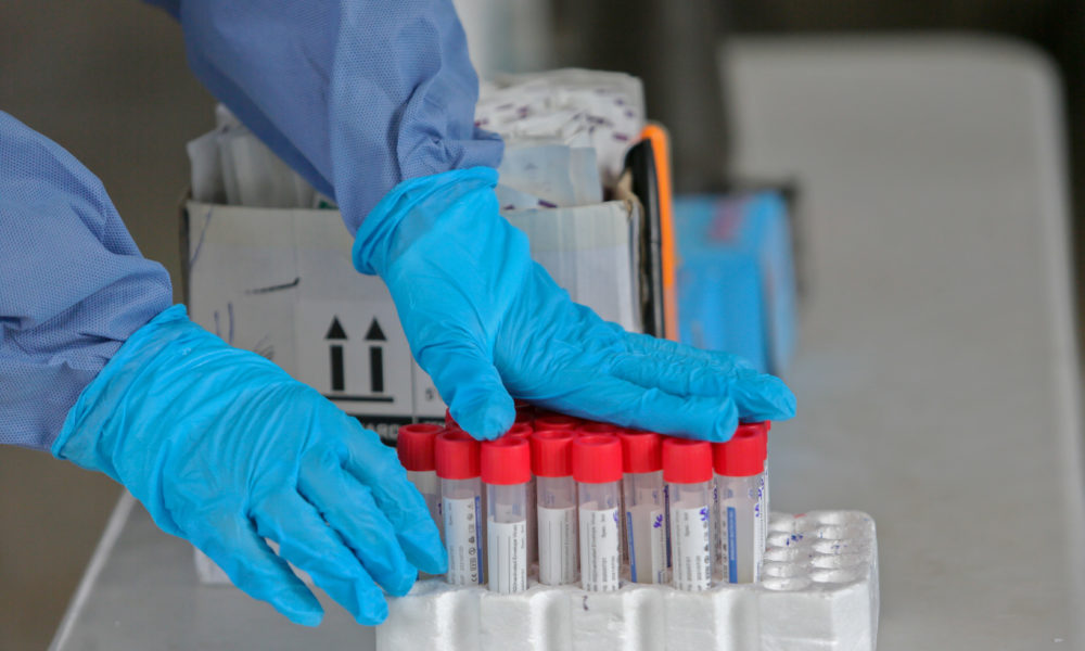 variantes, covid-19,