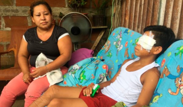 Adolescente pierde un ojo tras agresión de dos pitbulls en Chinandega