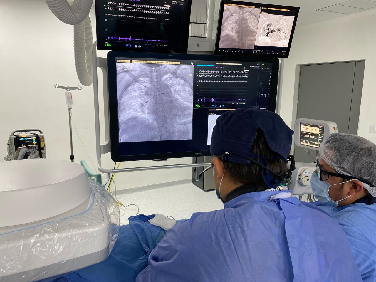 Realiza IMSS Morelos primera trombectomía percutánea en paciente con problemas para respirar