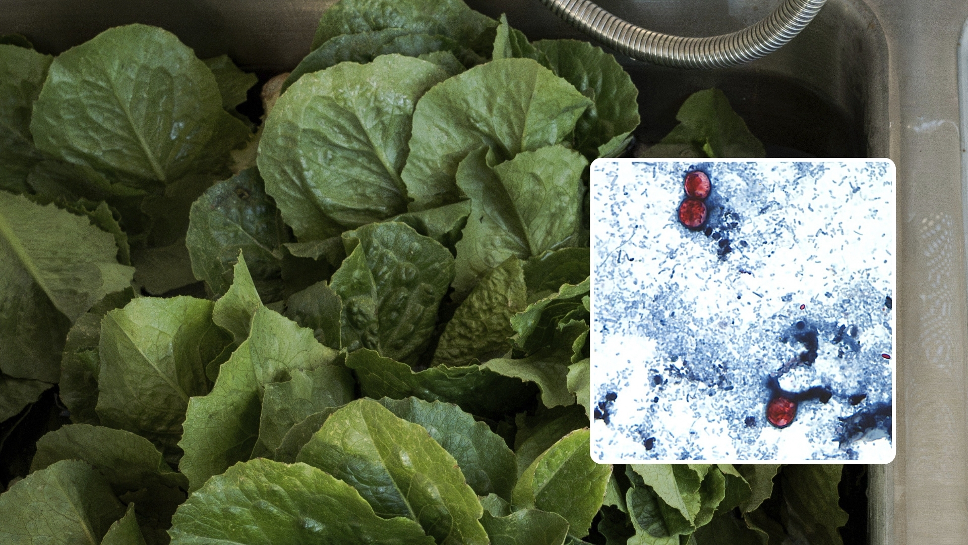 Cyclospora: el parásito detrás del mayor brote en EE.UU. y una alerta para México
