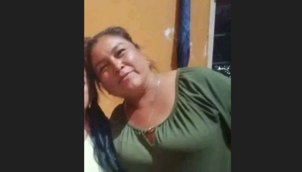 Mujer quemada