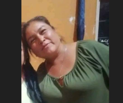 Mujer quemada