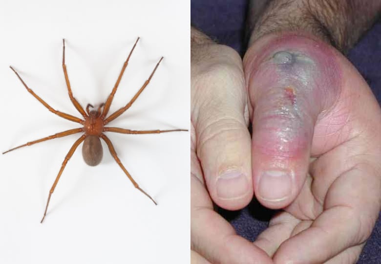 Araña violinista: Morelos entre los estados con más mordeduras; su veneno puede destruir tejidos y causar la muerte