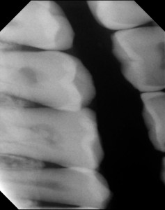 Gendex TM Size 2 Bitewing Image