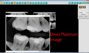 Dexis In Dexis - Clear Vue Applied