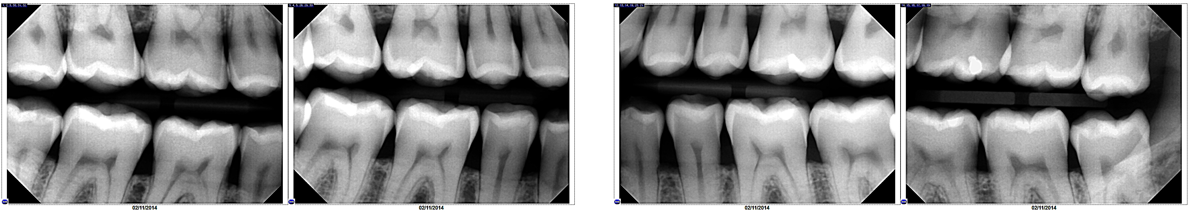 Quickray Digital X-Ray Sensor - Image 4