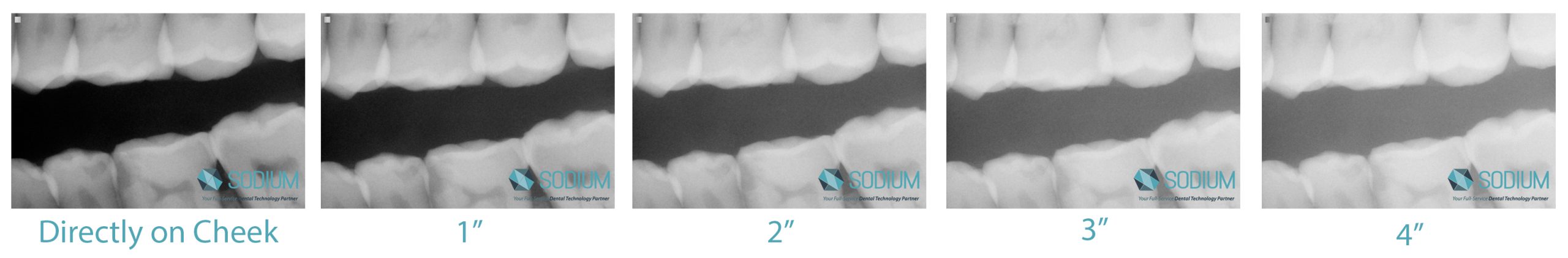 Why Every Dental Practice Should Be Using a Sensor Holder