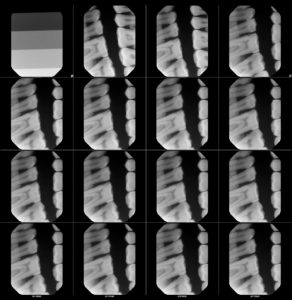 X-ray Repair Final Testing FMX