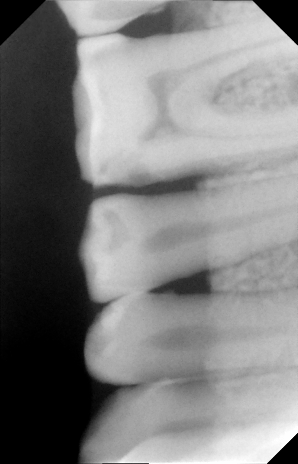 Refurbished Gendex VISUALIX EHD, size 1-Xray Repair