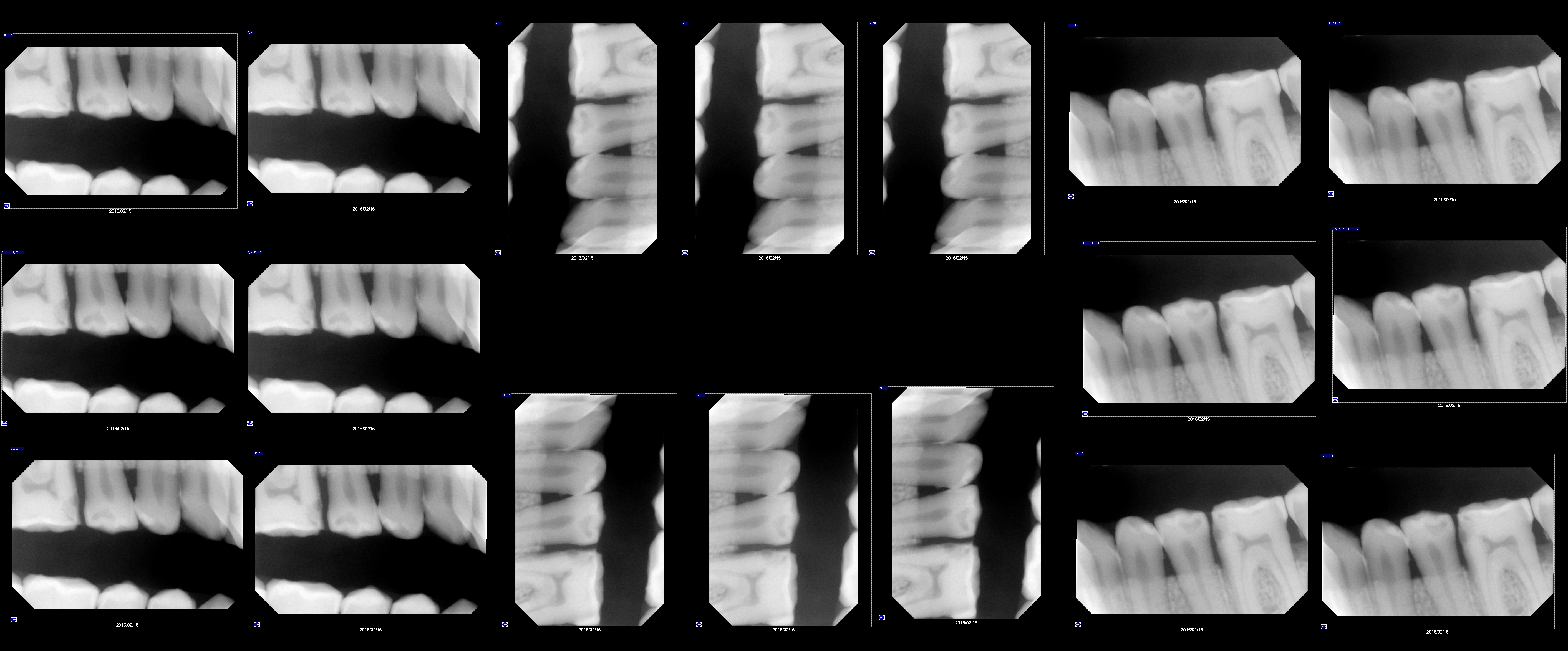 Refurbished Gendex VISUALIX EHD, size 1-Xray Repair