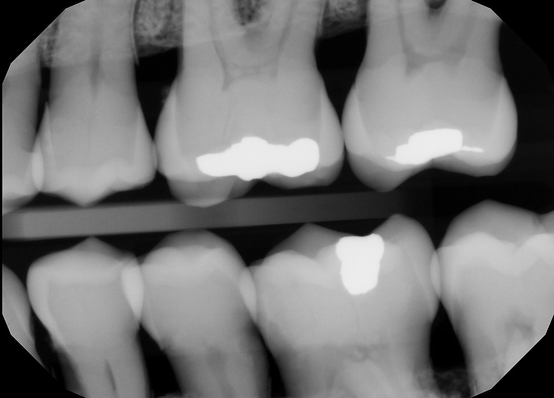 Pre-Owned Gendex GXS-700 Sensors Size: 2 - Image 4