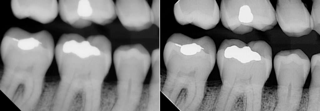 Enhanced X-Ray Images Two