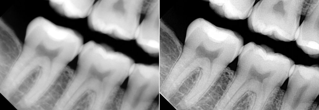 Enhanced X-ray Images One