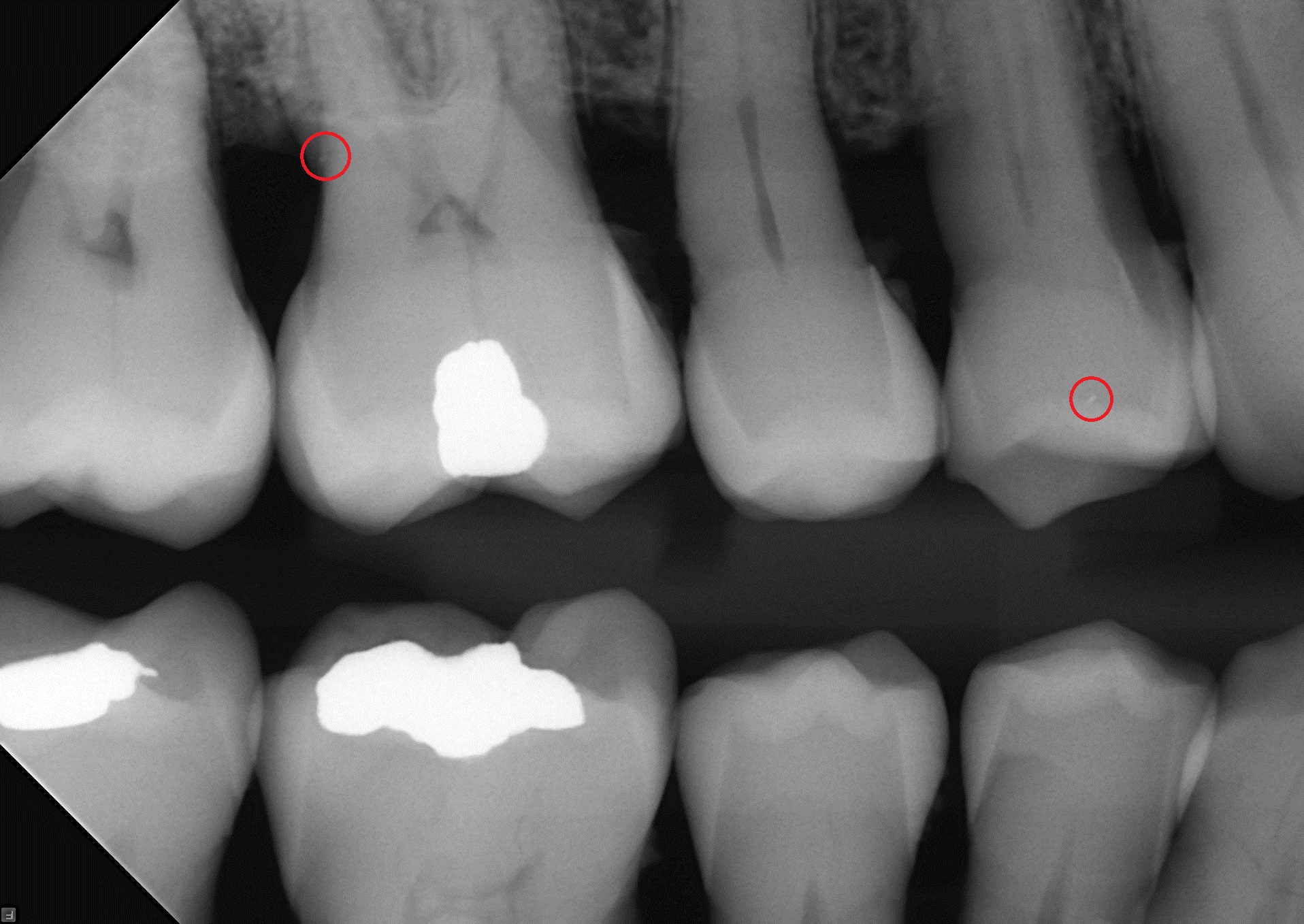 Refurbished Grade B Soredex Size 2 SN SA110461 - Image 8