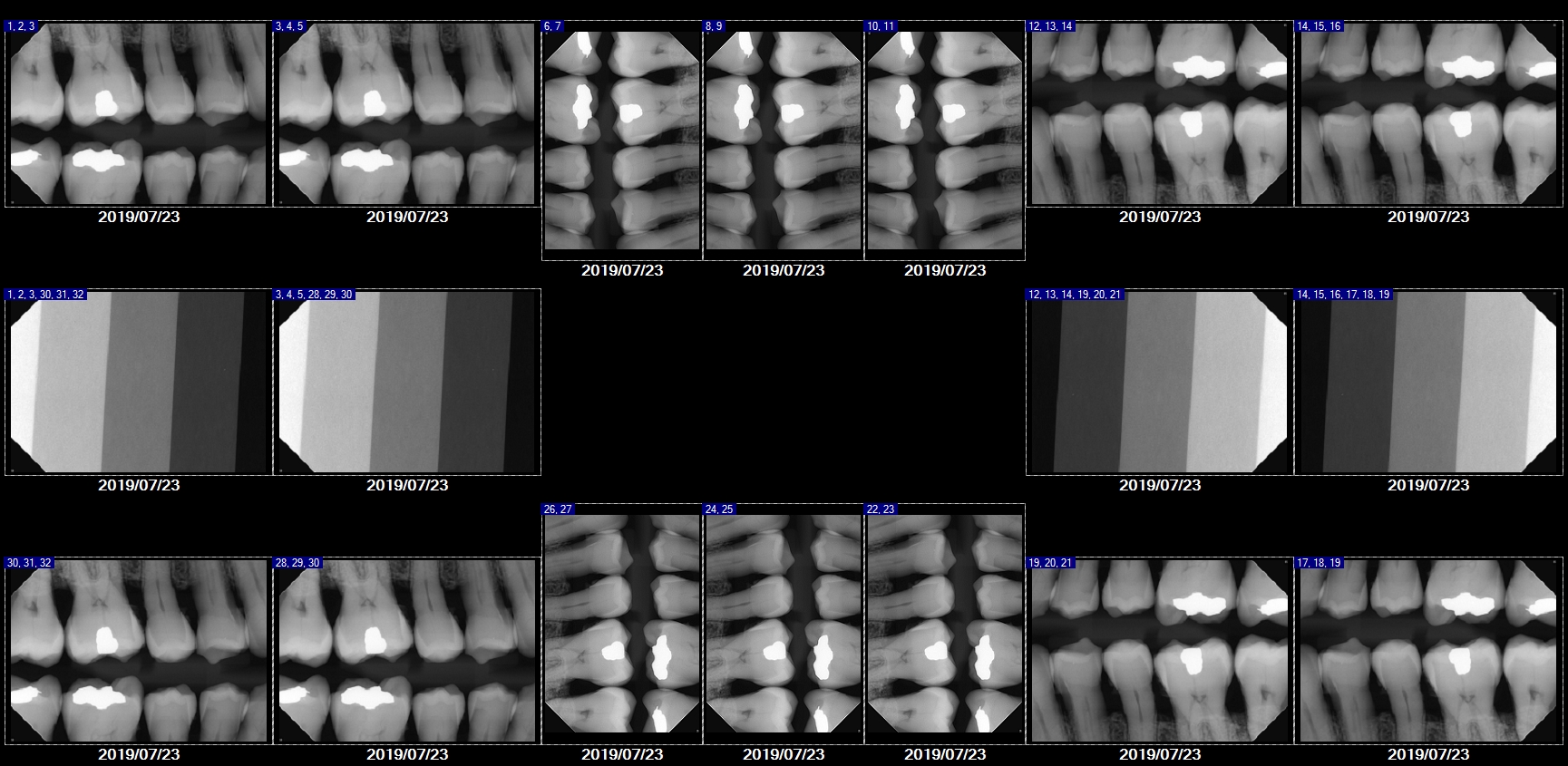 Refurbished Grade B Soredex Size 2 SN SA110461 - Image 7