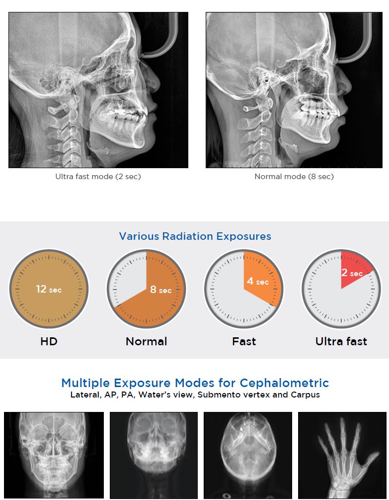 Genoray Papaya Premium 3DCT - Image 3