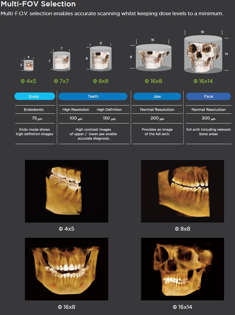 Genoray Papaya Premium 3DCT - Image 4
