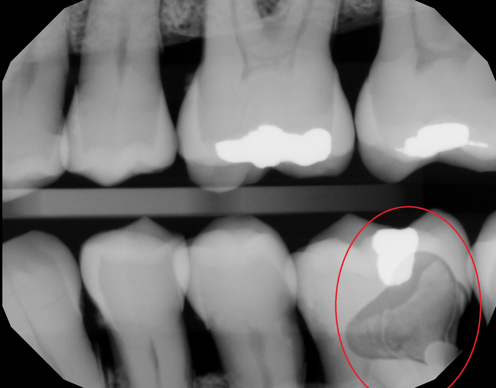 Grade B Refurbished Dexis Platinum SN 3170250914 - Image 4