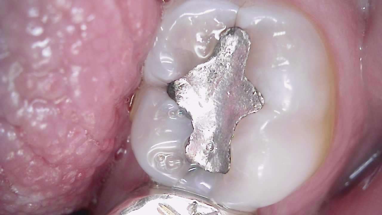 Dual Alpha Dental Camera - Image 12