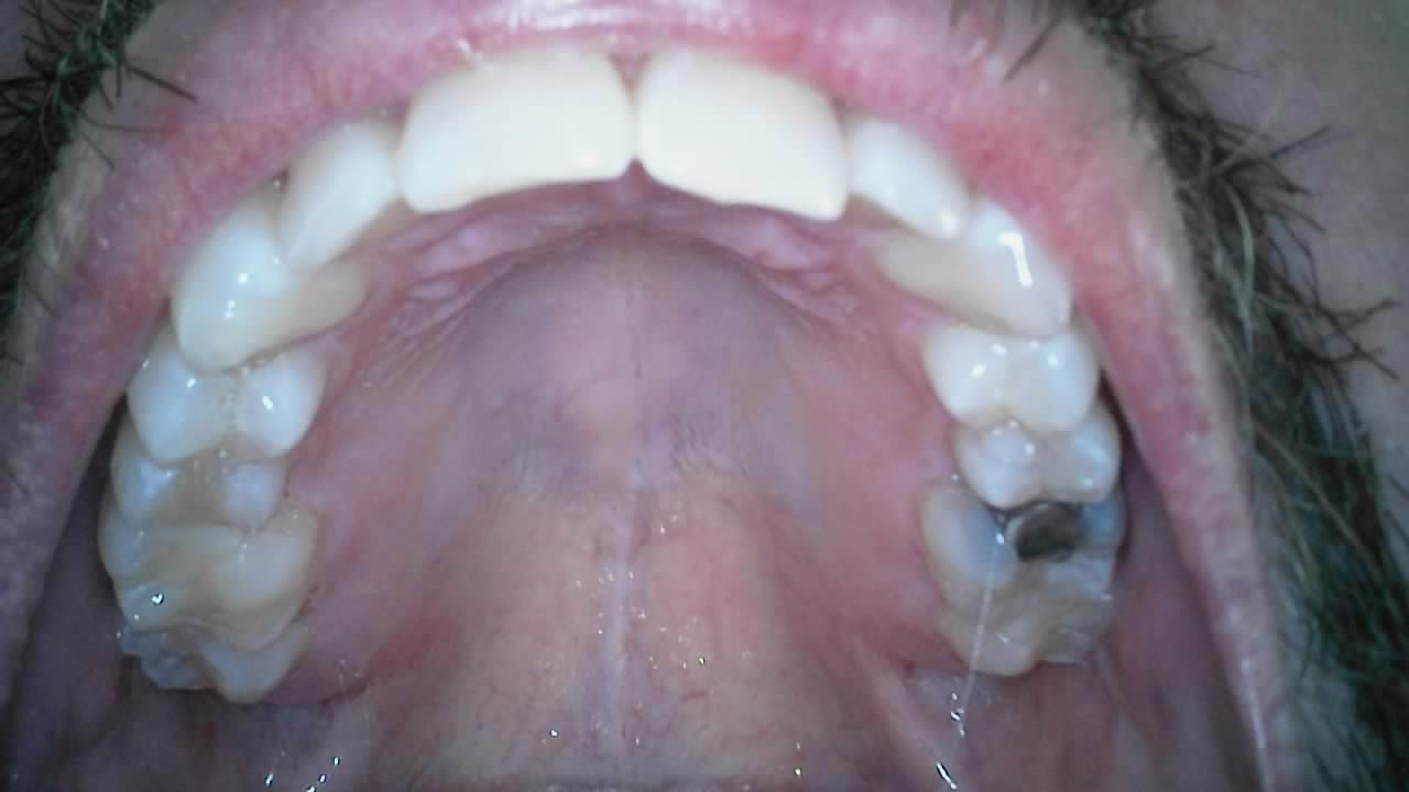 Dual Alpha Dental Camera - Image 10