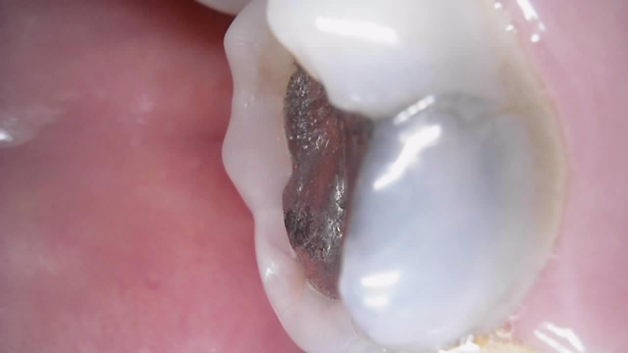 Dual Alpha Dental Camera - Image 8
