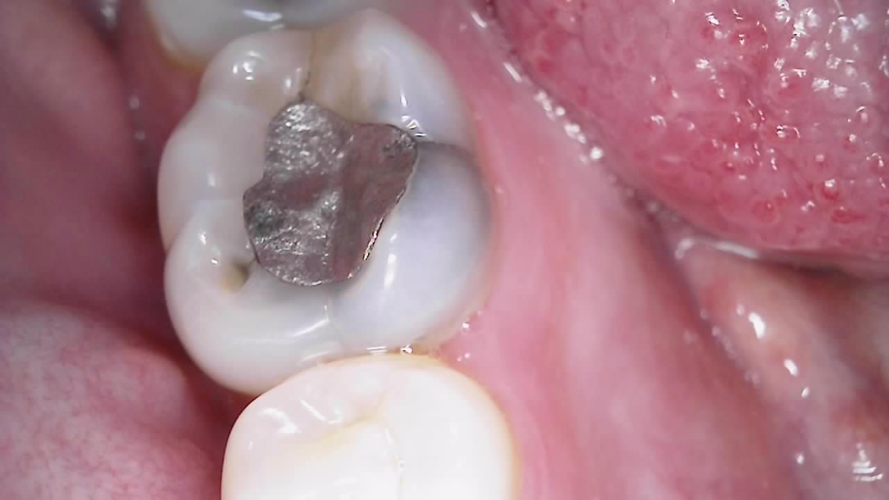 Dual Alpha Dental Camera - Image 7
