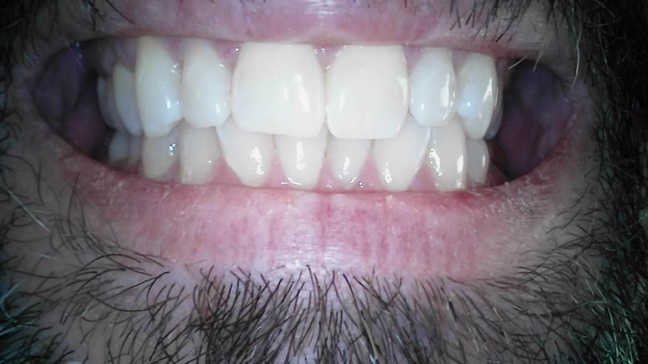 Dual Alpha Dental Camera - Image 6