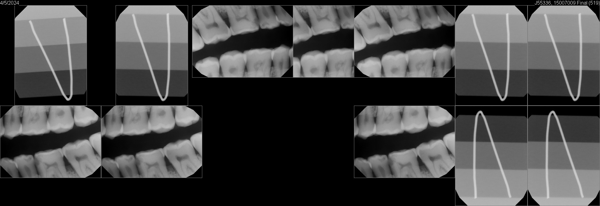 Pre-Owned Kavo IXS size 2 SN: 15007009 - Image 9