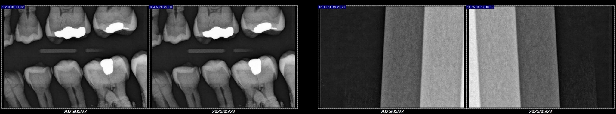 Pre-Owned Schick AE S2 Sensor SN 18002043 - Image 6