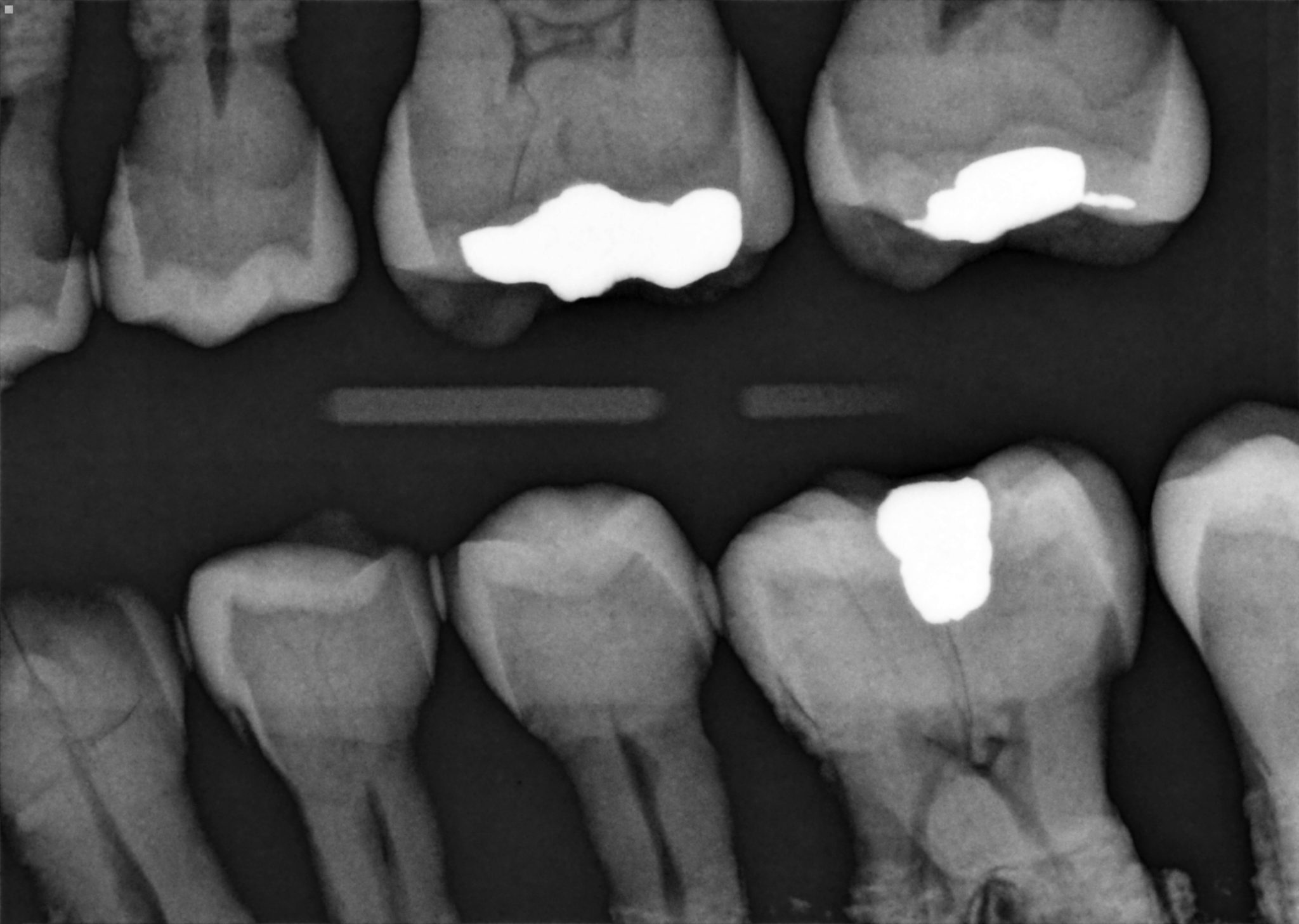 Pre-Owned Schick AE S2 Sensor SN 18002043 - Image 5