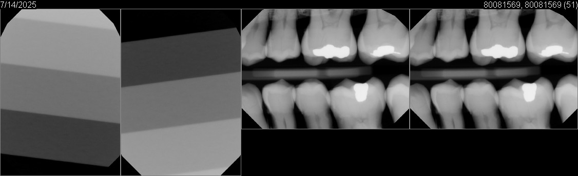 Pre-Owned Dexis IXS size 2 SN: 80081569 - Image 6