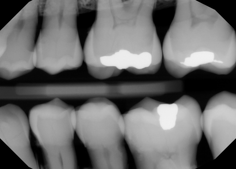 Pre-Owned Dexis IXS size 2 SN: 80081569 - Image 5