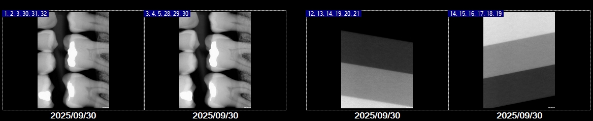 Refurbished Grade A Kodak RVG 6200 Size 1 FAJA0152 - Image 7