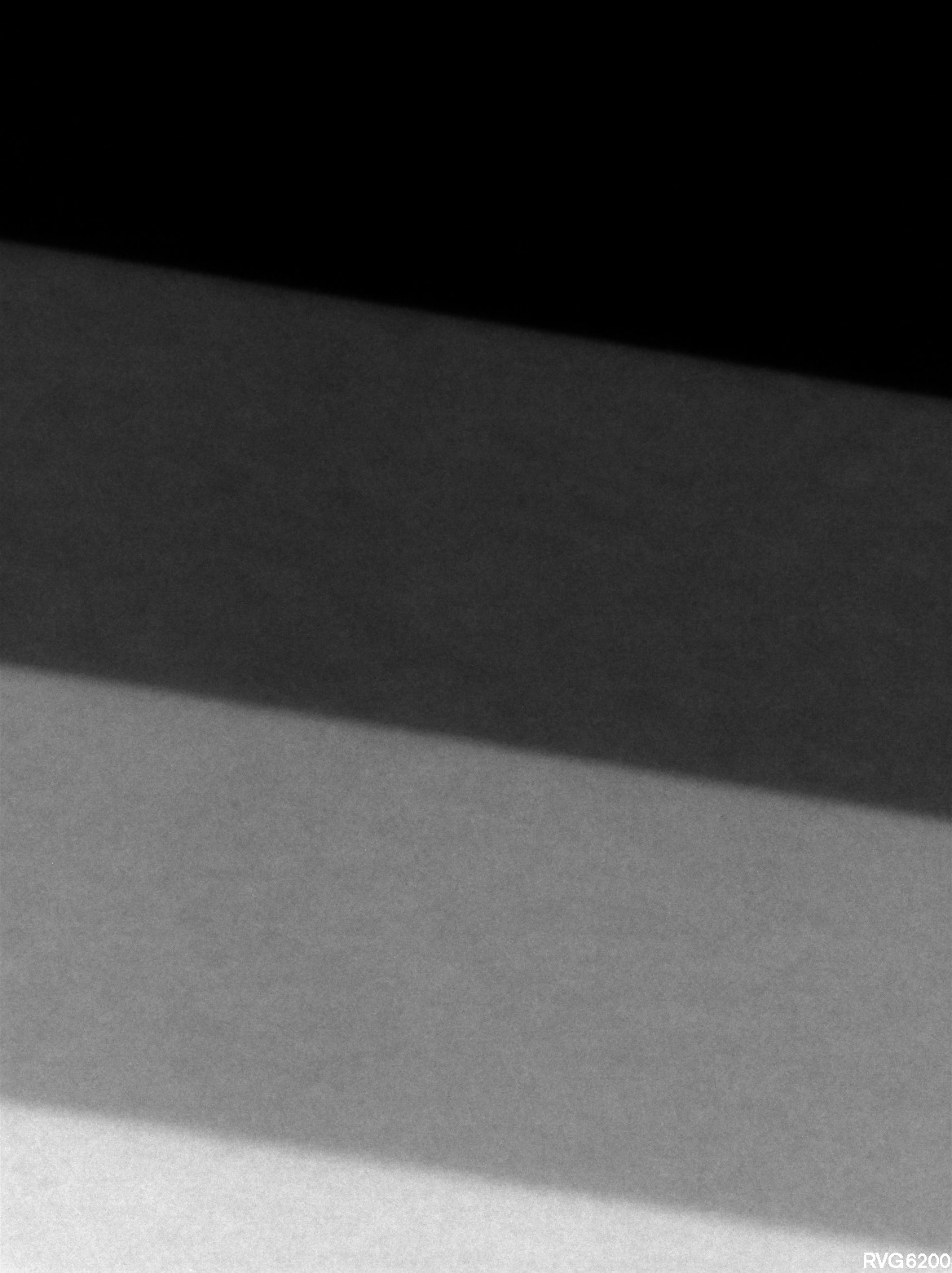 Refurbished Grade A Kodak RVG 6200 Size 1 FAJA0152 - Image 5