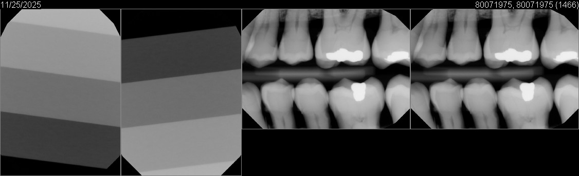 Pre-Owned Dexis IXS size 2 SN: 80071975 - Image 5