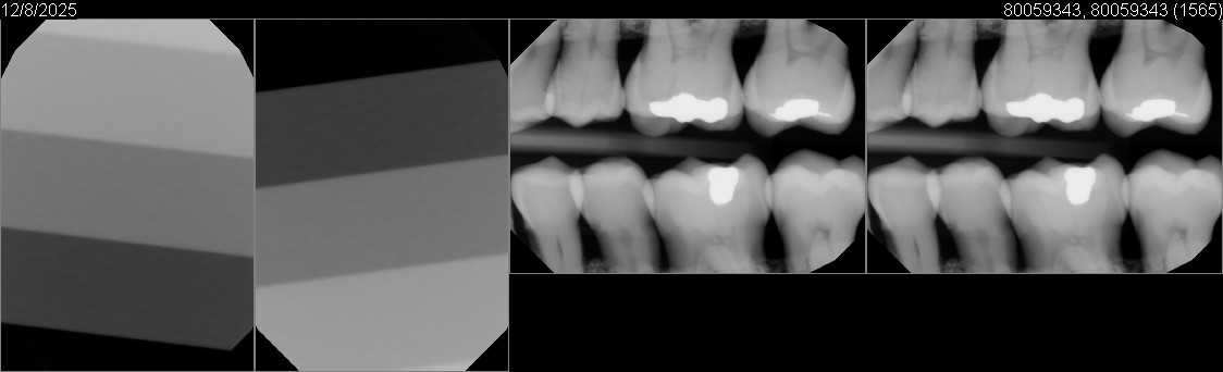 Pre-Owned Dexis IXS size 2 SN: 80059343 - Image 8