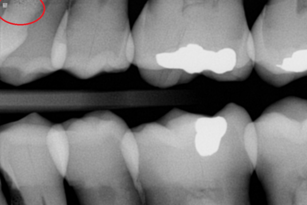 Pre-Owned Schick 33 Size 1 SN 11004509 - Image 7