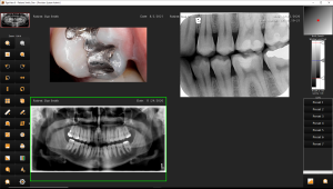 Sodium.Dental.image.Tigerview.multi.source.display