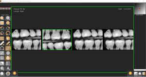 Sodium.Dental.image.Tigerview.dc-air.01