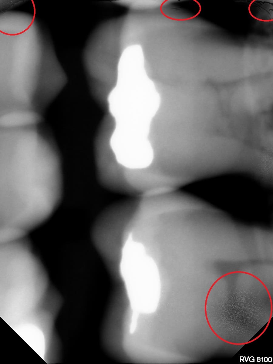 Pre-Owned Kodak 6100 Size 0 - SN BJGO056 - Image 3