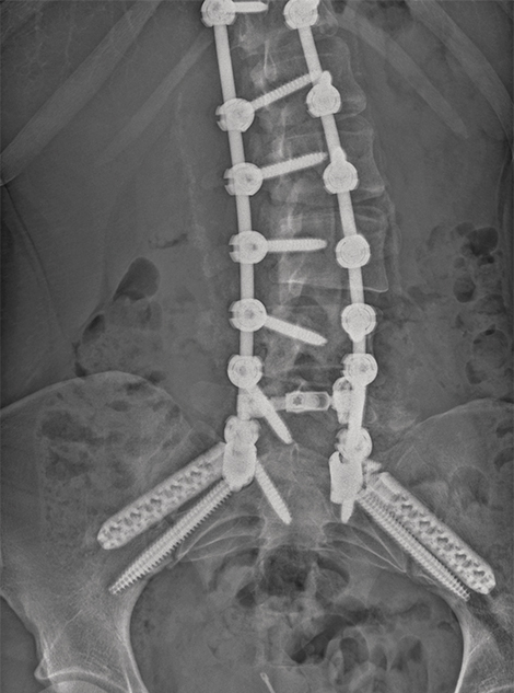Image Courtesy of Dr. Clifford Douglas (Loma Linda, CA)