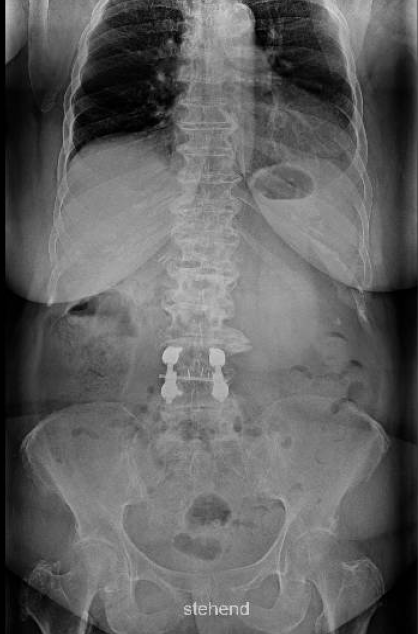 Pre-Op Image 2