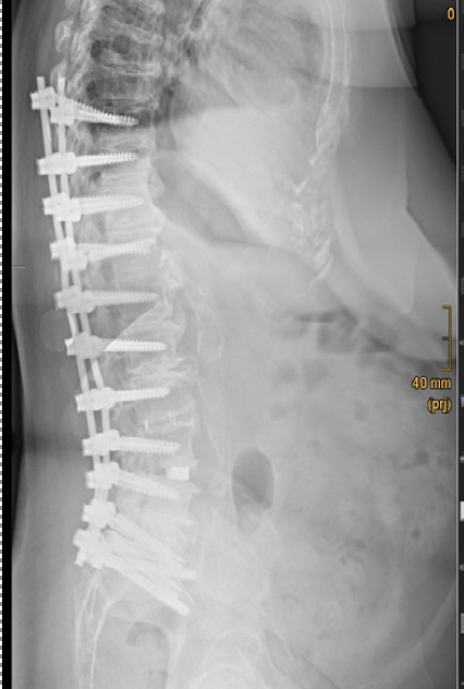 Post-Op Image 1