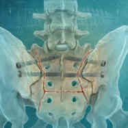 Provider home square 0001 pelvic trauma