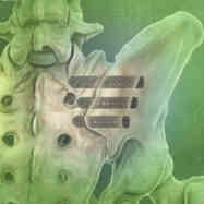 Provider home square 0002 si joint dysfunction 1